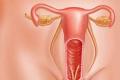 Symptoms of urethritis in women