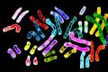 Chromosomal abnormalities sa mga bata